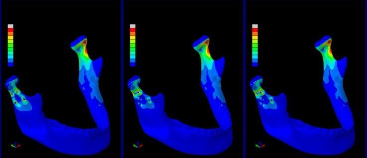 FEA assembly displacement