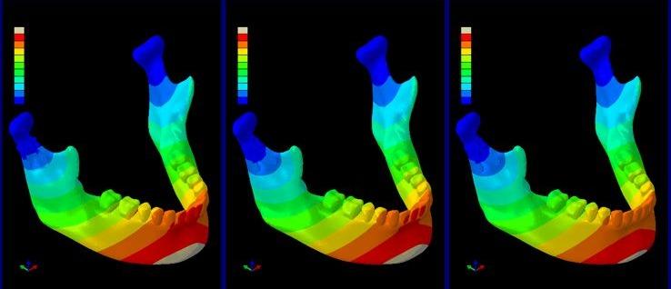 Analysis of the hard outer bone layer shows favorable conditions for healing when the Alpha Plate is used