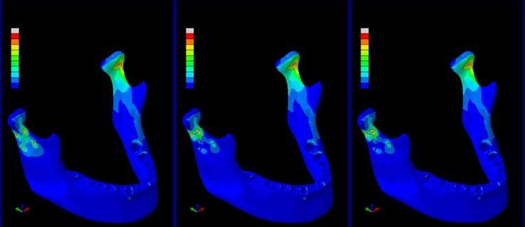 FEA displacement analysis