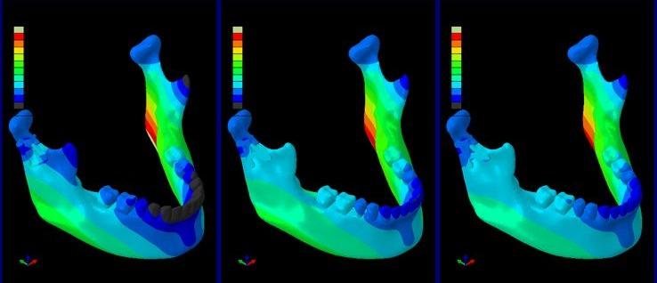 FEA strain comparison