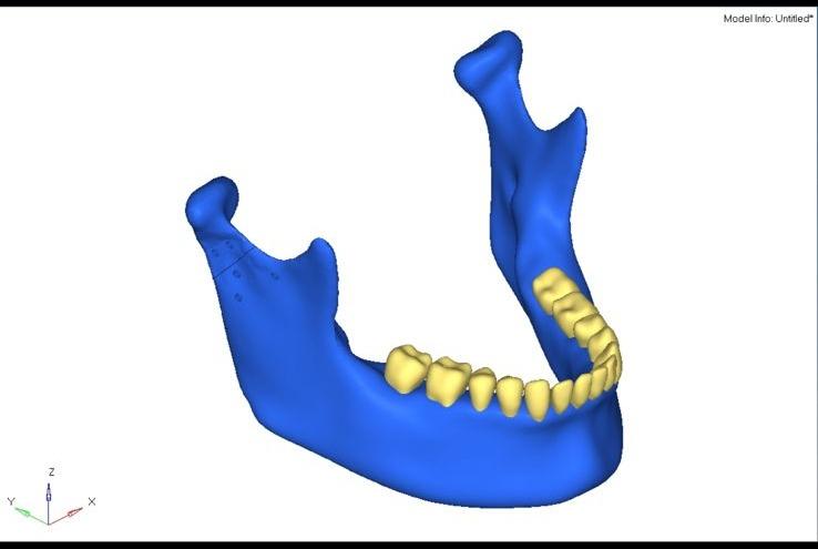 Mandible rear view