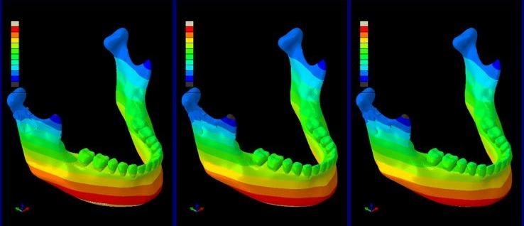 FEA validation study showing comprehensive biomechanical analysis